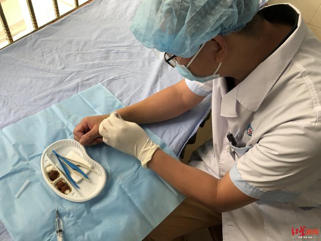 遂寧一院“狠醫(yī)生”左手給右手做手術，術后第二天就工作